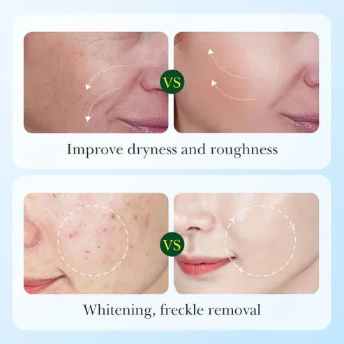 Sadoer - Licorice Root Whitening Skin Care Set
